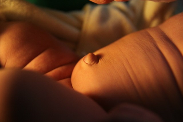 两个月的宝宝肚脐往外凸怎么办?