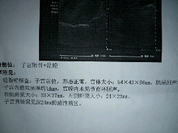 journal_insert_pic_271461364