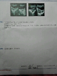 journal_insert_pic_430395314