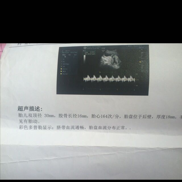 😌😌B超图片怎么看男孩女孩