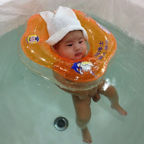 宝贝的小蛋蛋(睾丸)有点大,正常吗?附照片