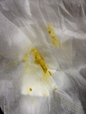 黄色中有些许绿色,软硬度象烂泥,我平时饮食偏素,2天吃顿肉,这大便