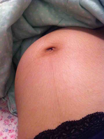 有没有宝妈怀孕后肚子毛毛很多