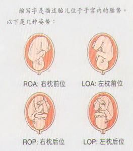 孕后期宝宝各种胎位图(附图)