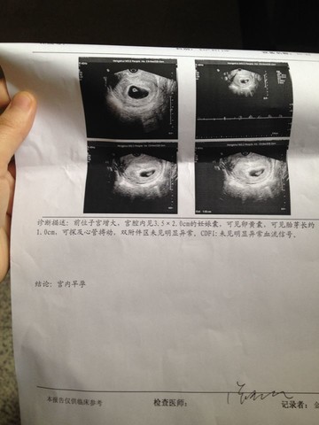 journal_insert_pic_121940449