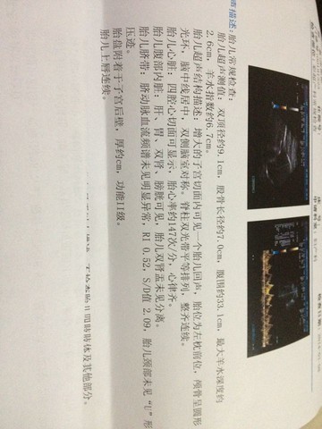 journal_insert_pic_122509787
