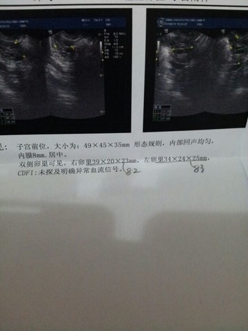 journal_insert_pic_122612109