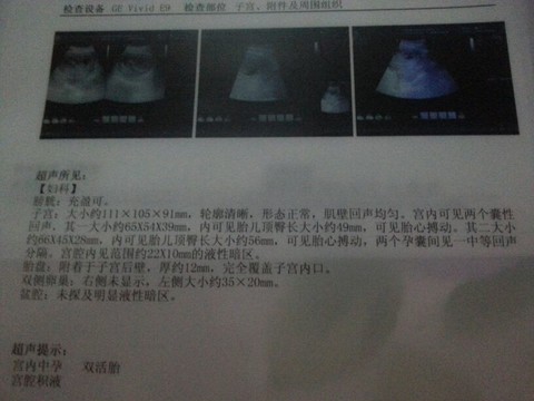 journal_insert_pic_123817518
