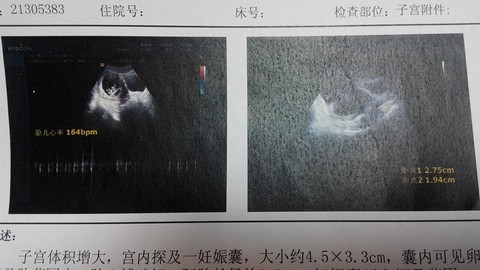 journal_insert_pic_124022974