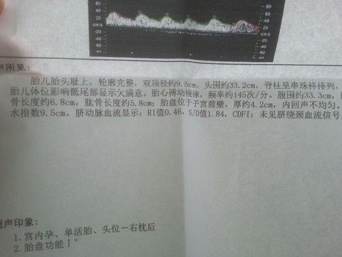 journal_insert_pic_124577375