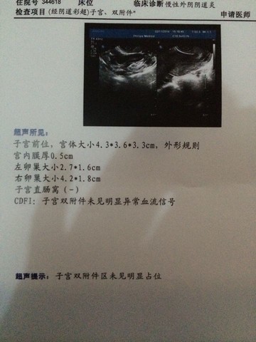 journal_insert_pic_125218708