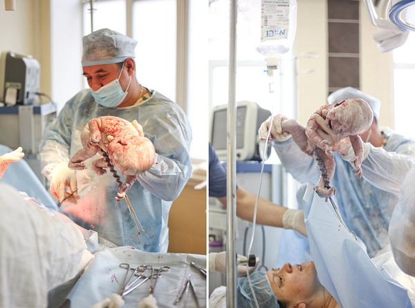 躺在产房中无聊的等待!_宝宝树