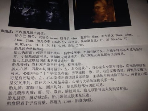 journal_insert_pic_125450363