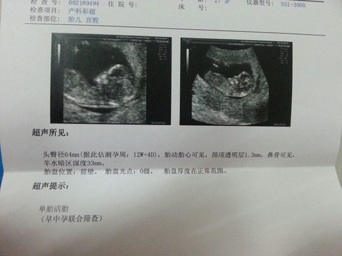journal_insert_pic_125610909