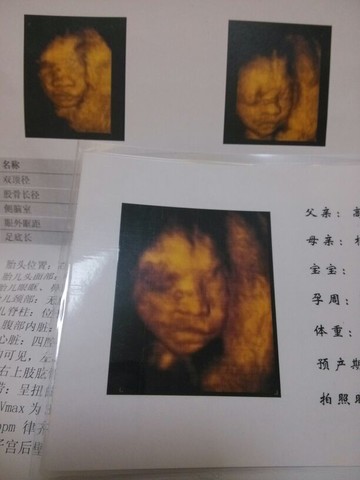 journal_insert_pic_125870913