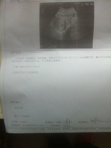 journal_insert_pic_126145875