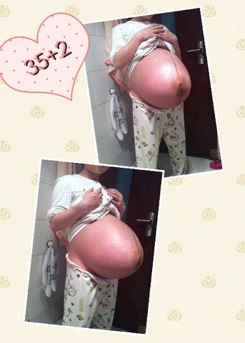 journal_insert_pic_126404593