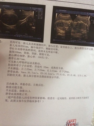 journal_insert_pic_126592339