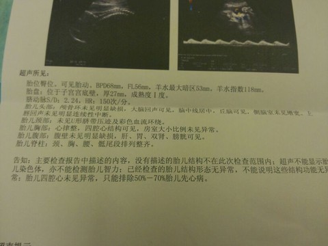 journal_insert_pic_127096847