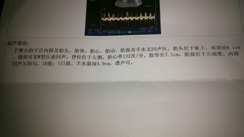 journal_insert_pic_127220822