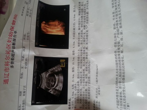 journal_insert_pic_127603165
