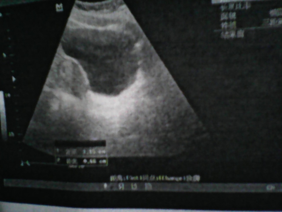 journal_insert_pic_129052957