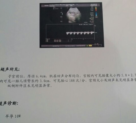 journal_insert_pic_129374627