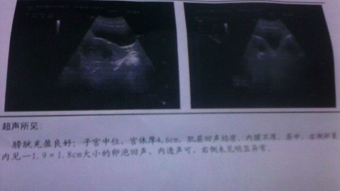 journal_insert_pic_129547250