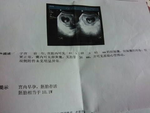 journal_insert_pic_129776816