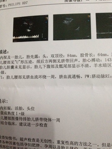 journal_insert_pic_130156551