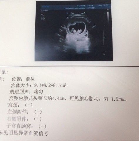 journal_insert_pic_130679410