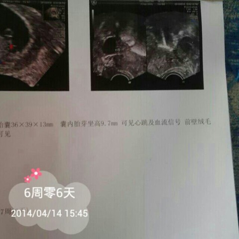 journal_insert_pic_132889301