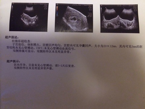 journal_insert_pic_133942368