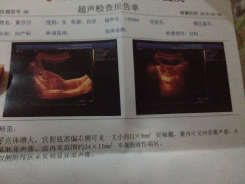 journal_insert_pic_134420443
