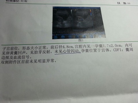 journal_insert_pic_136149257