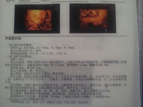 journal_insert_pic_138805457