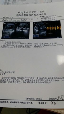 journal_insert_pic_139656268