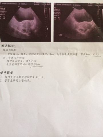 journal_insert_pic_140307585