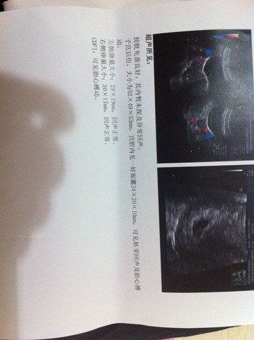 journal_insert_pic_140825597