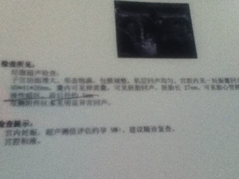 journal_insert_pic_140863148