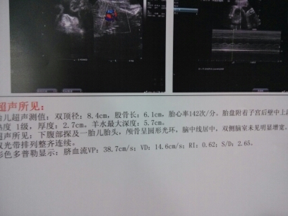 journal_insert_pic_141128795