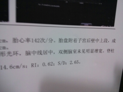 journal_insert_pic_141128799