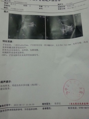 journal_insert_pic_141250050