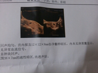 journal_insert_pic_141752476