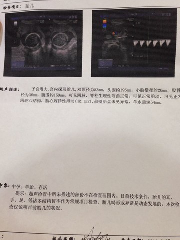 journal_insert_pic_142398269