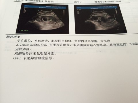 journal_insert_pic_143050648