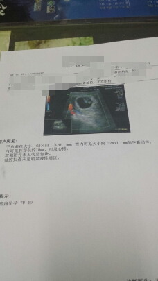 journal_insert_pic_143255976