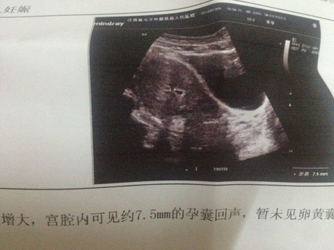 journal_insert_pic_143386051