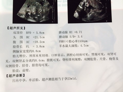 journal_insert_pic_143734657
