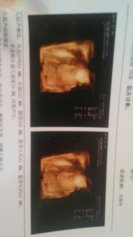 journal_insert_pic_143932212